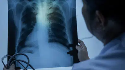 Neredeyse her evde yapılıyor: Akciğerlerde kalıcı hasara yol açabilir
