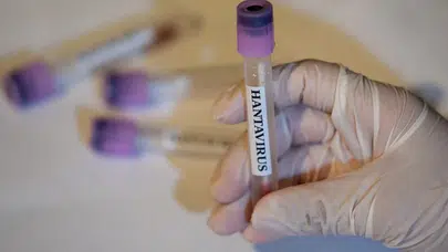 Sağlık Bakanı Kemal Memişoğlu’ndan hantavirüs açıklaması: Türkiye’de görüldü mü?