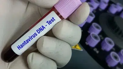 DSÖ’den gemide ortaya çıkan hantavirüs için “risk düşük” açıklaması
