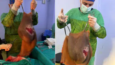 Karın ağrısıyla hastaneye başvurdu: Karnından 40 kilogramlık kitle çıkarıldı