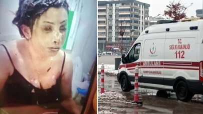 Bunun adı saf kötülük! Eşini koli bandıyla bağlayıp kezzapla yaktı