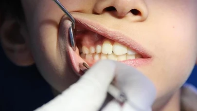 Ölenlerin altın dişlerini çaldı! Cenaze görevlisi hakkında dava açıldı