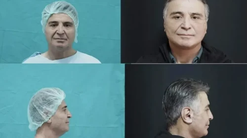 Bitlis Devlet Hastanesi’nde bir ilk gerçekleşti: Estetikte yeni dönem