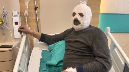 Kalorifer kazanına benzin döktü, yüzü yandı: “Ben yandım kimse yanmasın”