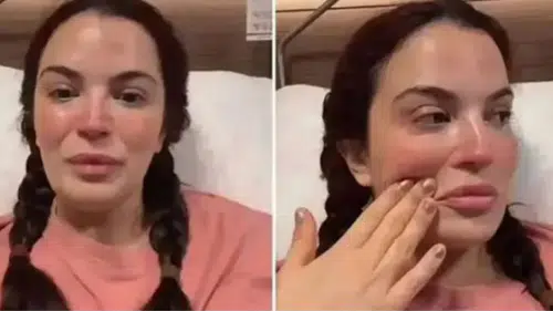 Aslı Bekiroğlu 9. kez bıçak altına yatacak: Nedenini açıkladı
