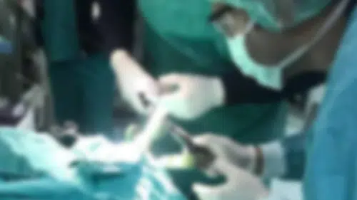 3 yaşındaki çocuk 25 mıknatıslı top yuttu: 21 parça operasyonla çıkarıldı