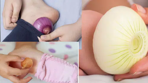Çorabın içine soğan koyup uyumak faydalı mı? İşte gerçekler