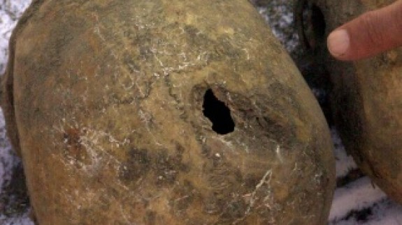 Bilimsel kazılarla Ermeni çetelerinin katliamları