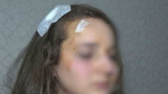 Muşta ile genç kızı acımazsızca darp etti: 'Abimi öldüren kıza benzettim' dedi