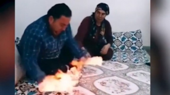 Bu kadarına da pes! TikTok videosu için eşinin ellerini çakmakla yaktı