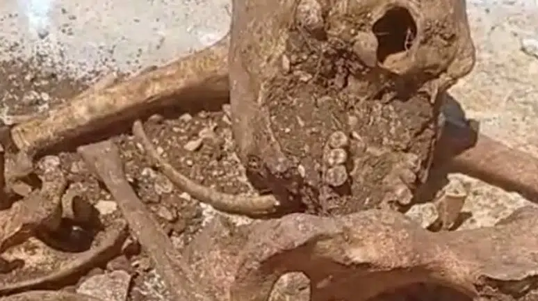 Malatya'da temel kazısı sırasında insan kemikleri bulundu