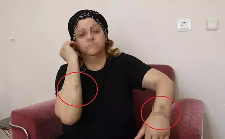 16 yıl birlikte yaşadığı kişi tarafından 30 yerinden bıçaklandı