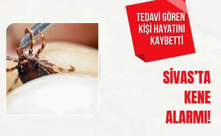 Sivas’ta kene alarmı: Tedavi gören kişi hayatını kaybetti