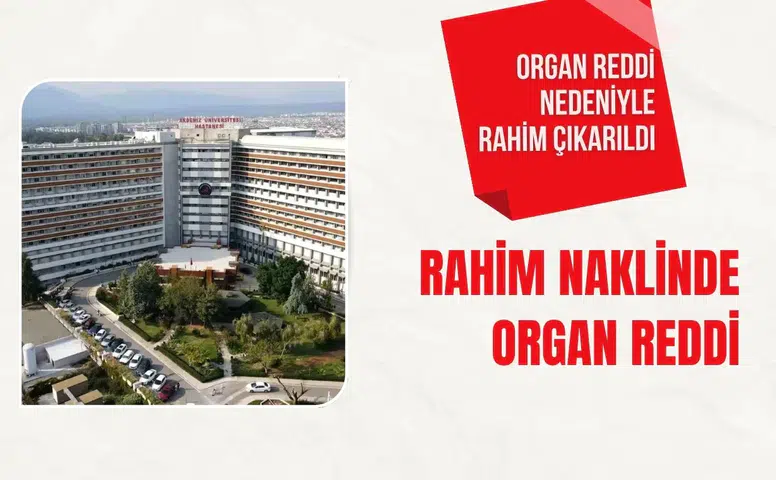 Akdeniz Üniversitesi'nde rahim naklinde organ reddi gelişti