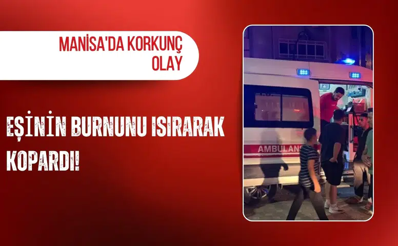 Manisa'da korkunç olay: Eşinin burnunu ısırarak kopardı