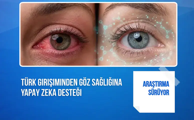 Türk girişiminden göz sağlığına yapay zeka desteği: Araştırma sürüyor