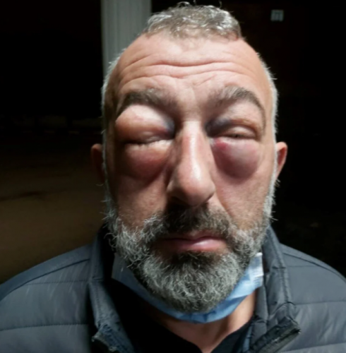 Kocaeli'de halk otobüsü şoförlerinden yolcuya dayak 1