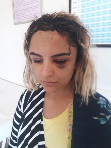 Kısmet Ağar dini nikahlı eşi tarafından öldürülme korkusuyla yaşıyor 1