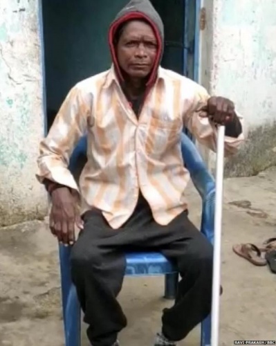 55 yaşındaki felçli adam,  koronavirüs aşısı yaptırdıktan sonra yürümeye başladı 6