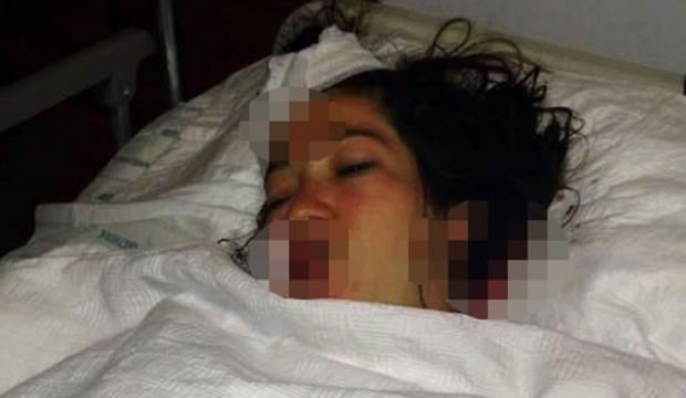 MEB'den eşini hastane odasında bıçaklayan kişiyle ilgili açıklama