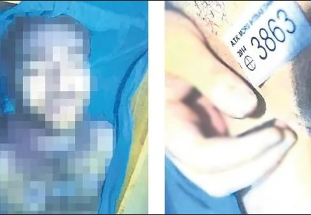 Cem Garipoğlu Otopsi