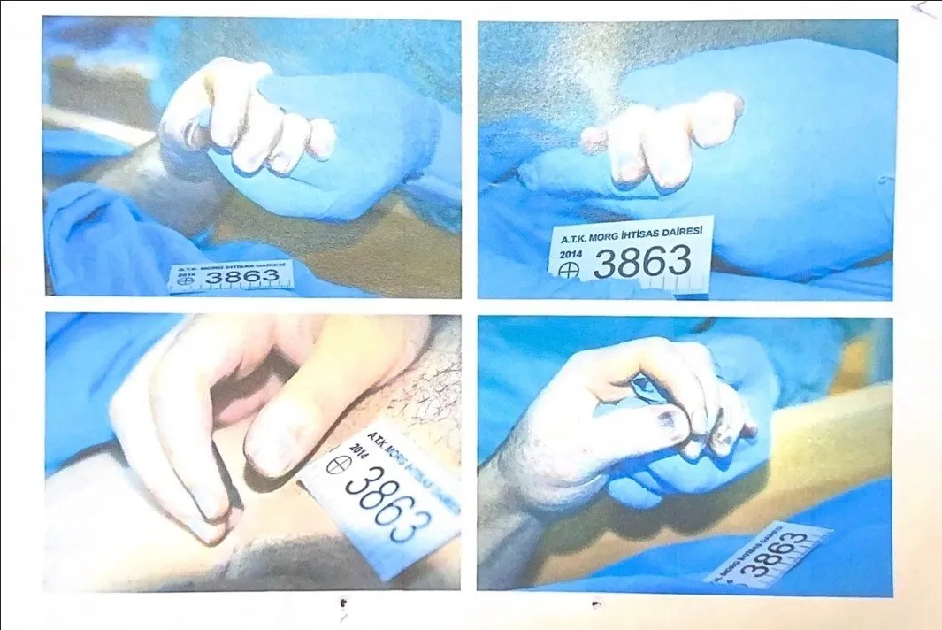 Otopsi̇ Morarmalar Cem Gari̇poğlu