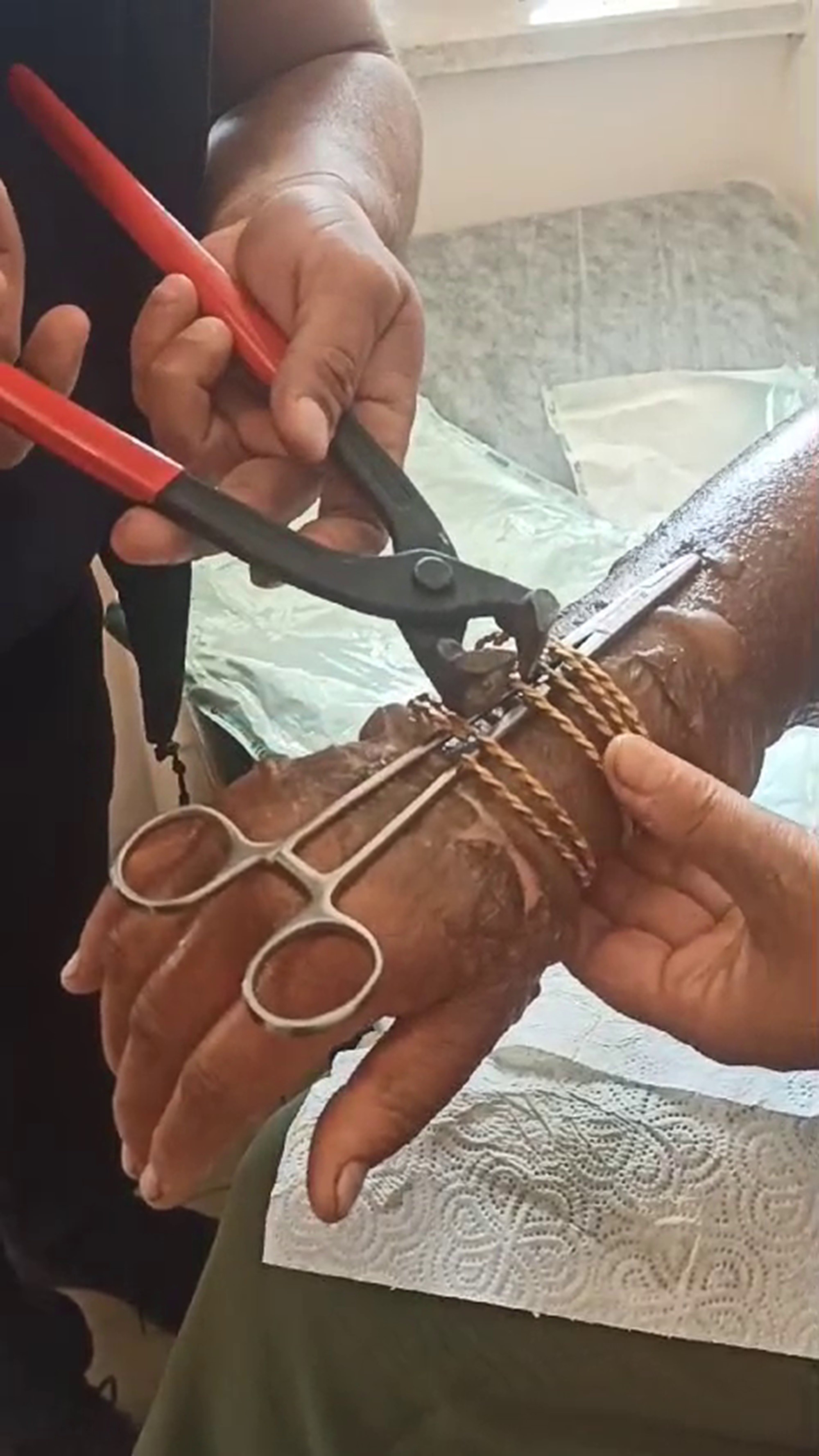 Kolu yanan kadının bilezikleri itfaiye tarafından kesilerek çıkarıldı